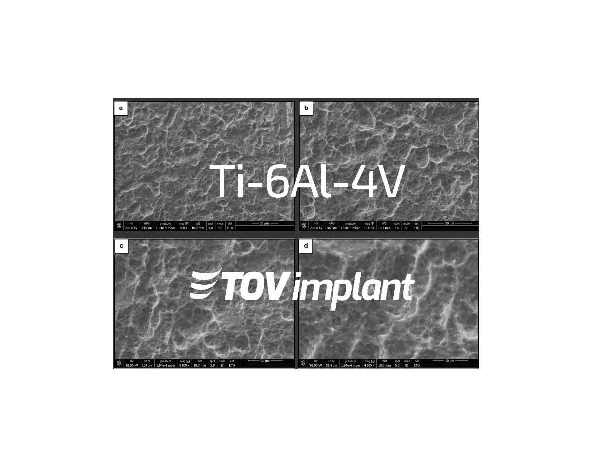 Uso de Titanio Grado 5 para los Implantes Dentales